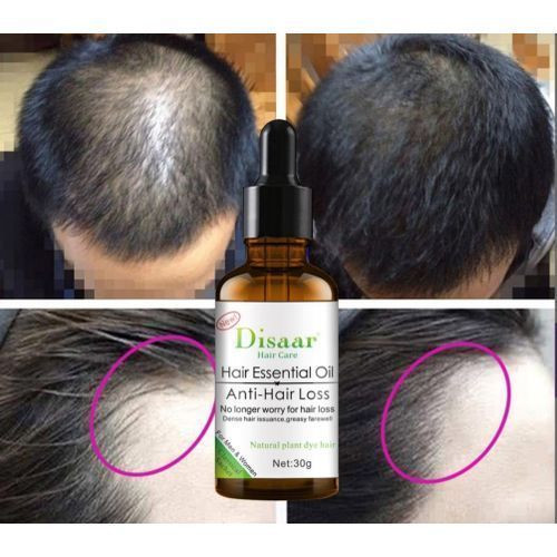 Hair Care Essence Oil For Anti Hair Loss 30g